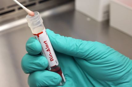 Brazil Reports First Monkeypox Death Amid Current Outbreak That Caused Global Health Emergency