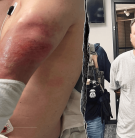 ICE Agent Dragged by Illegal Alien